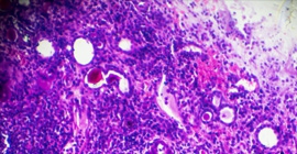 lkidney cells